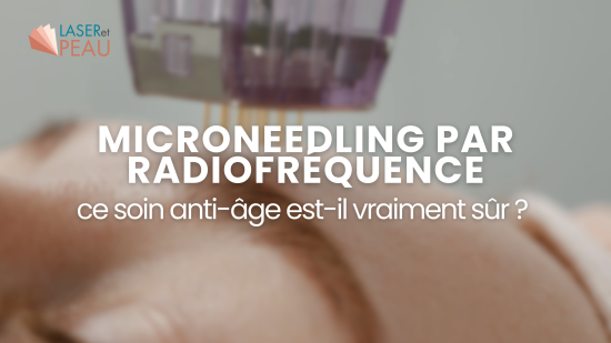 Microneedling par radiofréquence : ce soin anti-âge est-il vraiment sûr ? 